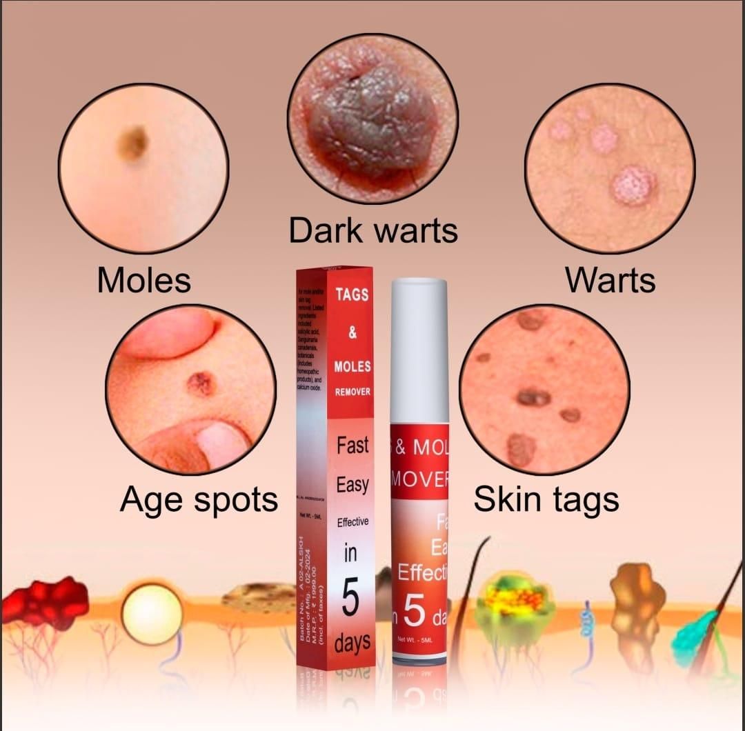 Professional Skin Tag & Mole Removal Device – Flawless Skin At Home